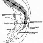 ganglia impar diagram www.hpssandiego.com