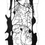Anterior Lumbar Vertebral Plexus Image from "Clinical Anatomy of the Lumbar Spine and Sacrum" by Nikolai Bogduk