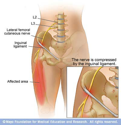 lateral femoral cutaneous nerve dermatome