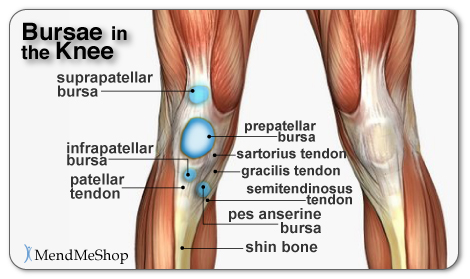 Anserine bursitis steroid injection