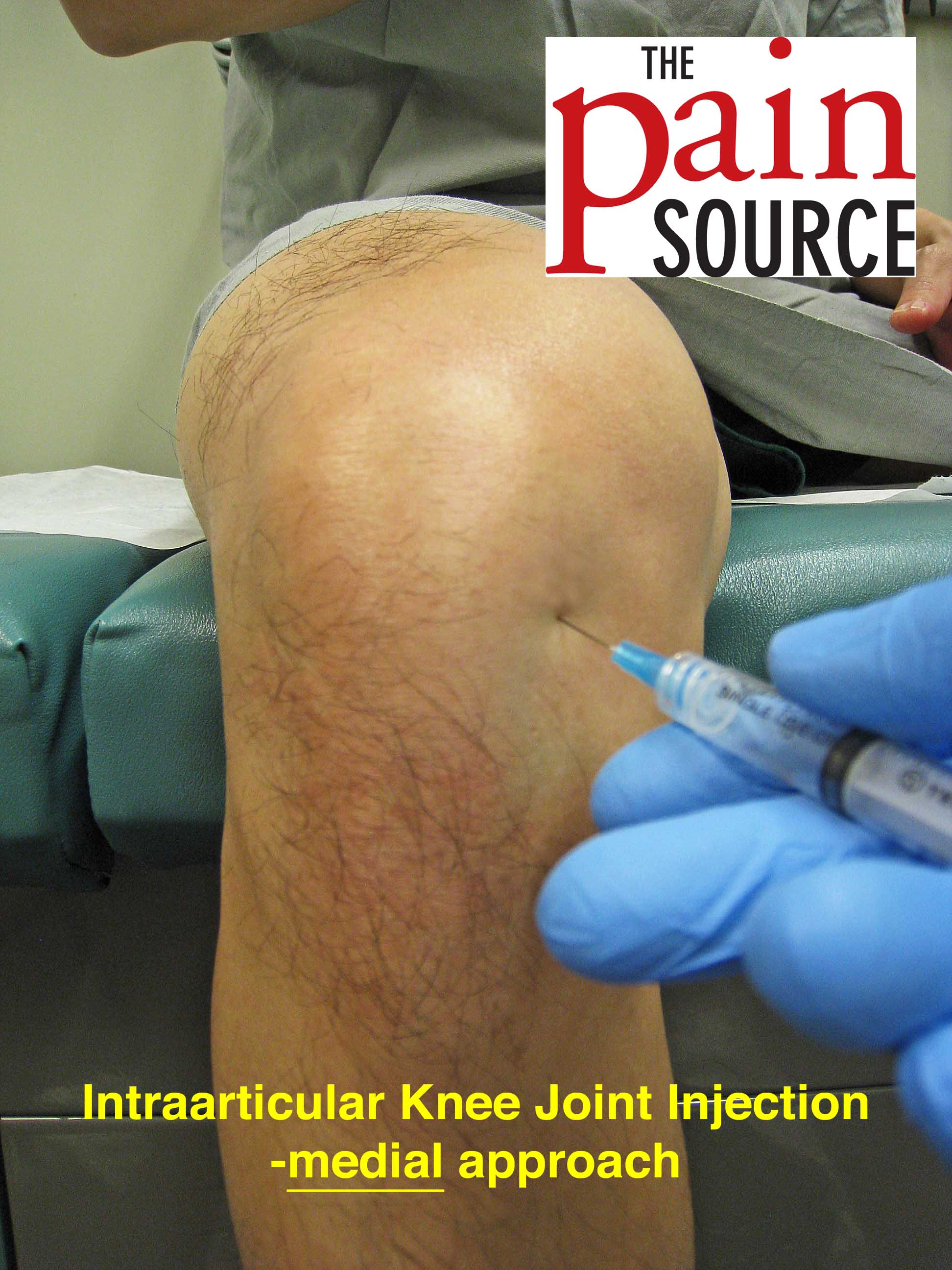 care after steroid injection in knee