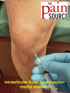 Knee steroid injection indications
