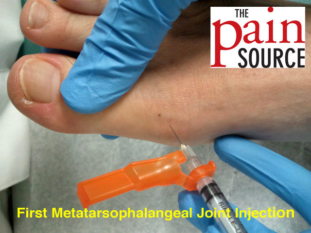 osteoarthritis first metatarsophalangeal joint icd 10