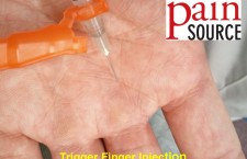 Steroid versus placebo injection for trigger finger