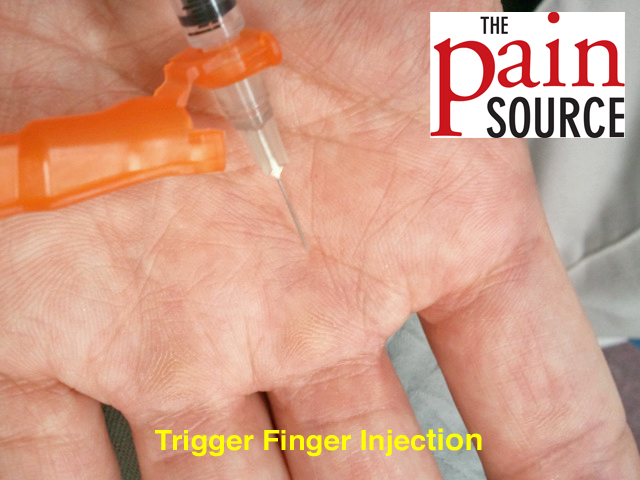 Trigger Finger Injection