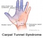 Source: MedicineNet.com