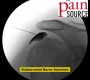 VIDEO:  Subacromial Bursa Injection under fluoroscopy