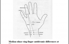 split ring