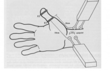 split thumb