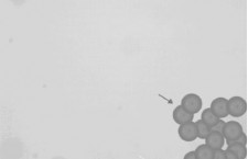 Betamethasone with lidocaine (microscopic)