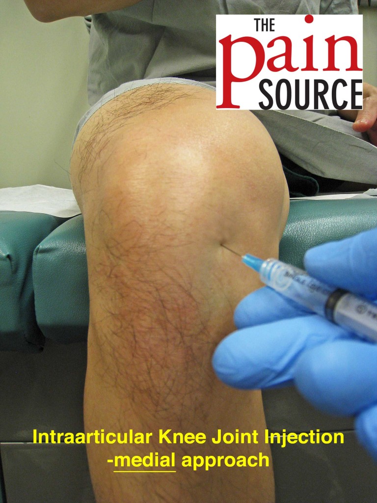 What is the new injection for knee pain?