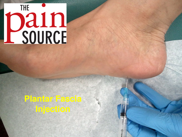 A Guide To Conservative Care For Recalcitrant Plantar Heel Pain