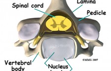 Cervical Spine Anatomy – Axial Cut