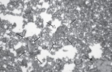 Kenalog in blood (microscopic)
