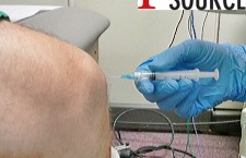 Prepatellar Bursa Aspiration and injection – side view