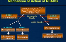 Mechanism of Action of NSAIDs
