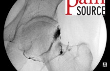 Hip Injection with fluoroscopy – Step 04 – ThePainSource