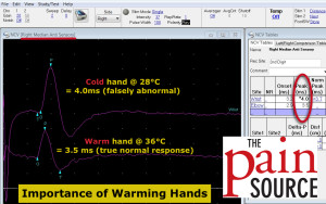 Importance of Warming Hands for NCS - median nerve - The Pain Source